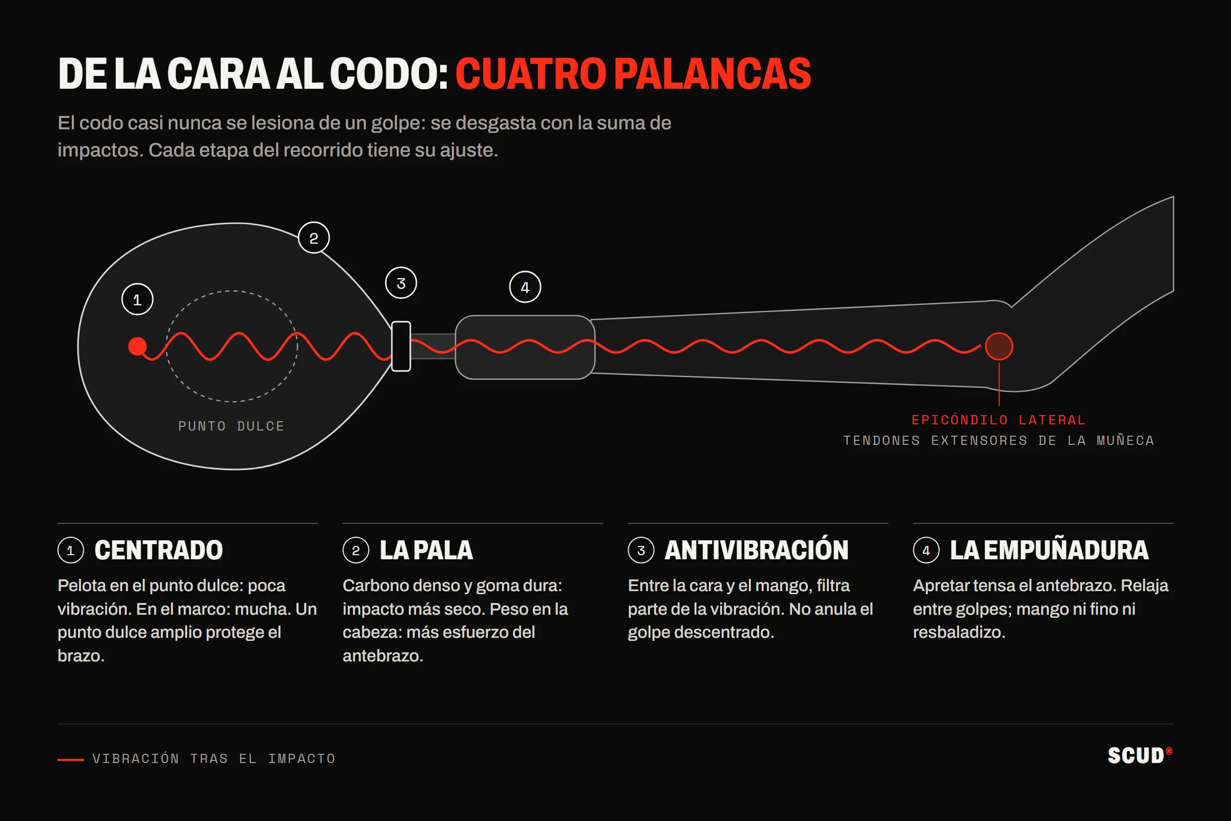 Esquema de una pala sujeta en la mano y de un antebrazo: una onda roja sale de una pelota golpeada en el borde de la cara, pasa por el antivibración y el mango y sube por el antebrazo hasta el epicóndilo lateral; cuatro palancas numeradas: el centrado, la pala, el antivibración y la empuñadura